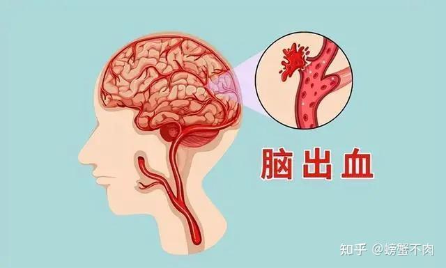 高血压的危害你注意了吗？